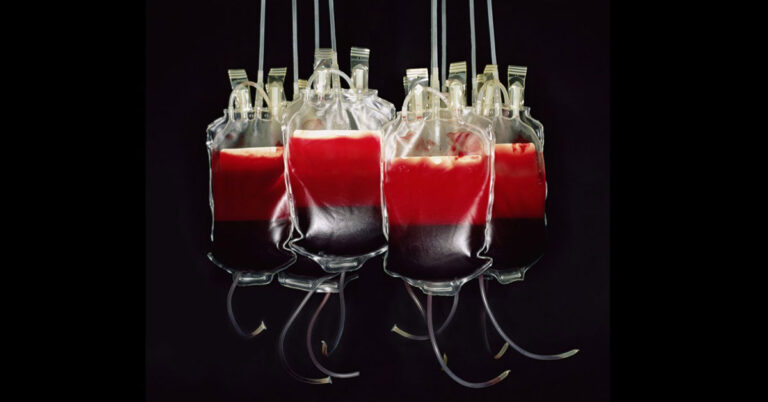 خون عطیہ کرنے کی اربوں ڈالر کی مارکیٹ، امریکیوں کی آمدن کا ذریعہ